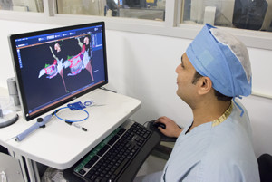 3D Mapping Technology for Ablation